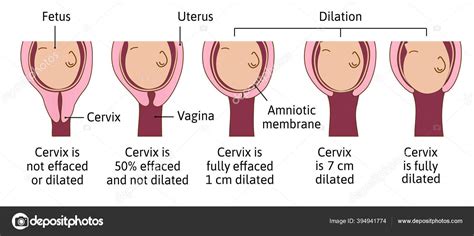 Can You Swim If Your Cervix Is Dilated? Exploring the Intersection of Physiology and Metaphor